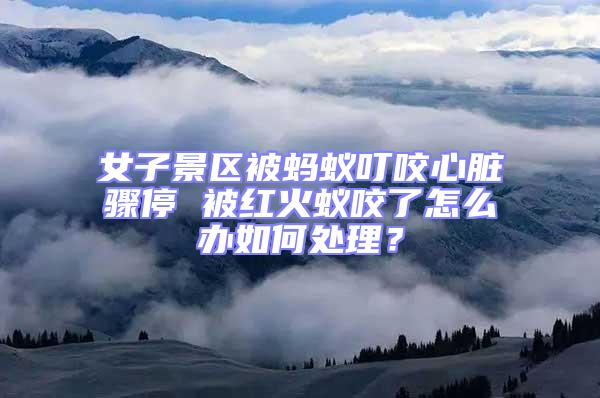 女子景區(qū)被螞蟻叮咬心臟驟停 被紅火蟻咬了怎么辦如何處理？